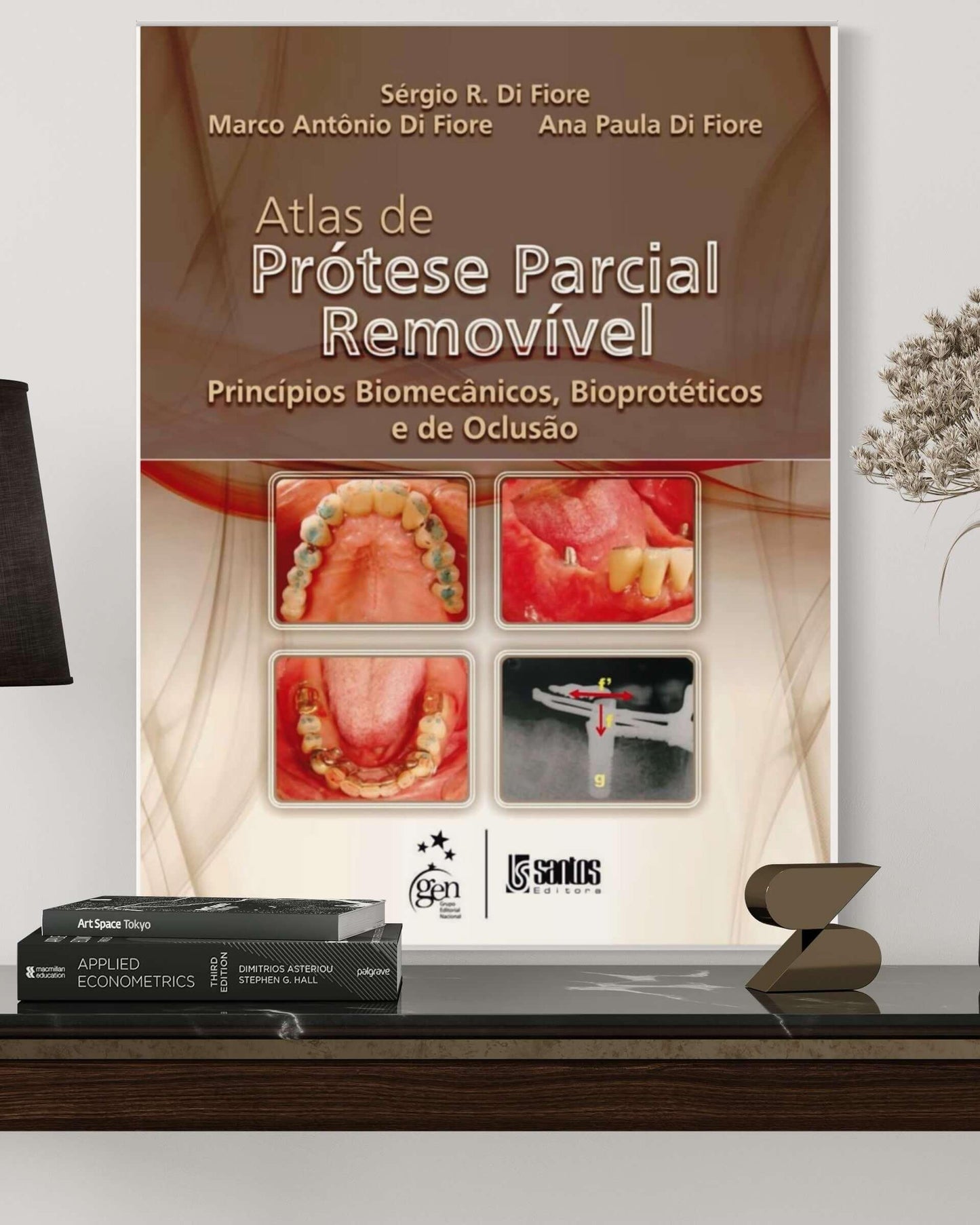 Atlas de Prótese Parcial Removível - Princípios Biomecânicos e Bioprotéticos e de Oclusão - Di Fiore - Estante Digital