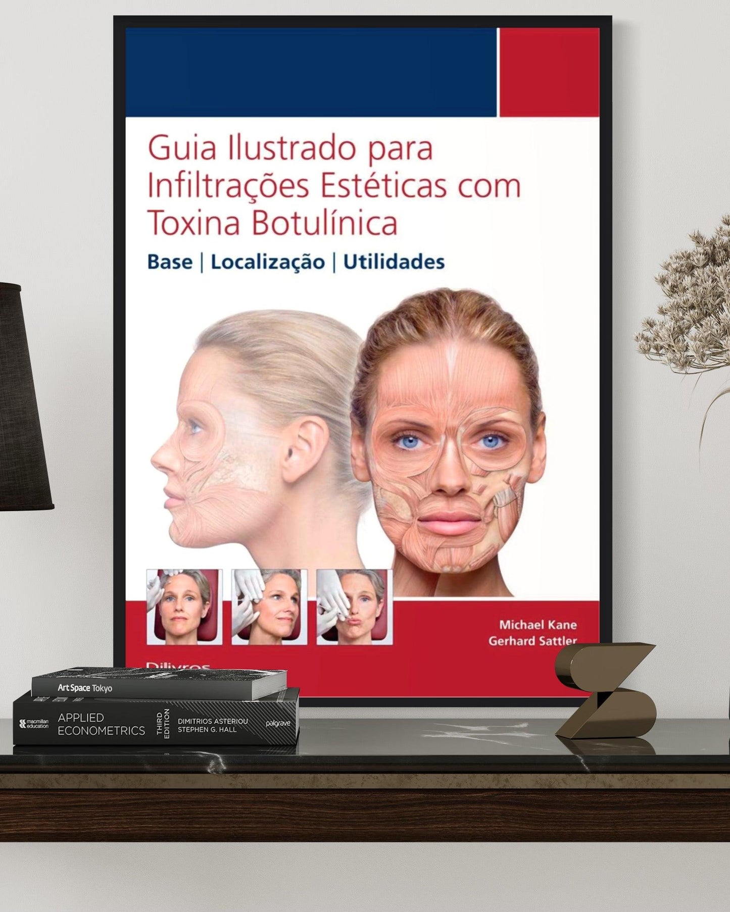 Guia Ilustrado Para Infiltracoes Esteticas Com Toxina Botulínica - Estante Digital