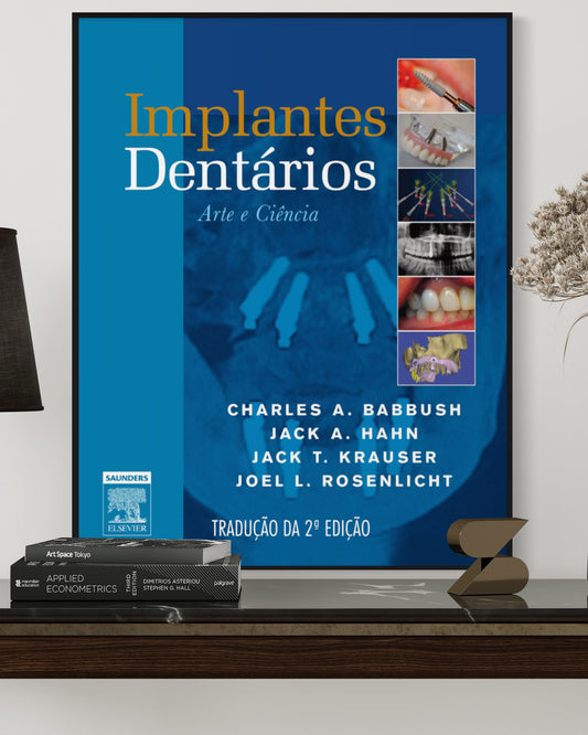 Implantes Dentários - Arte e Ciência - 2ª Edição - Estante Digital